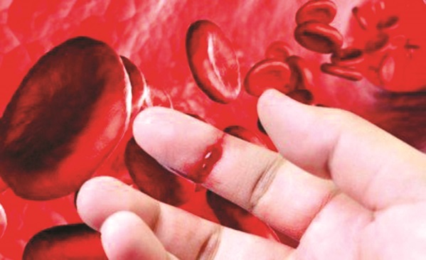 Hemophilia - bệnh thường di truyền cho con trai - ảnh 1