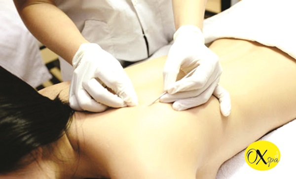 Suýt tử vong vì trị mụn ở lưng - ảnh 2