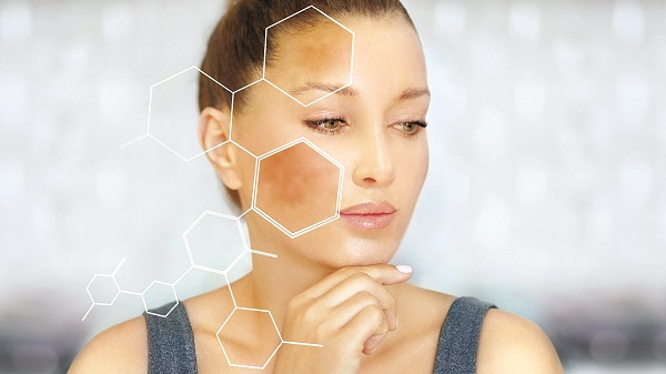 Sạm nám da - Nguyên nhân và cách phòng ngừa - ảnh 1