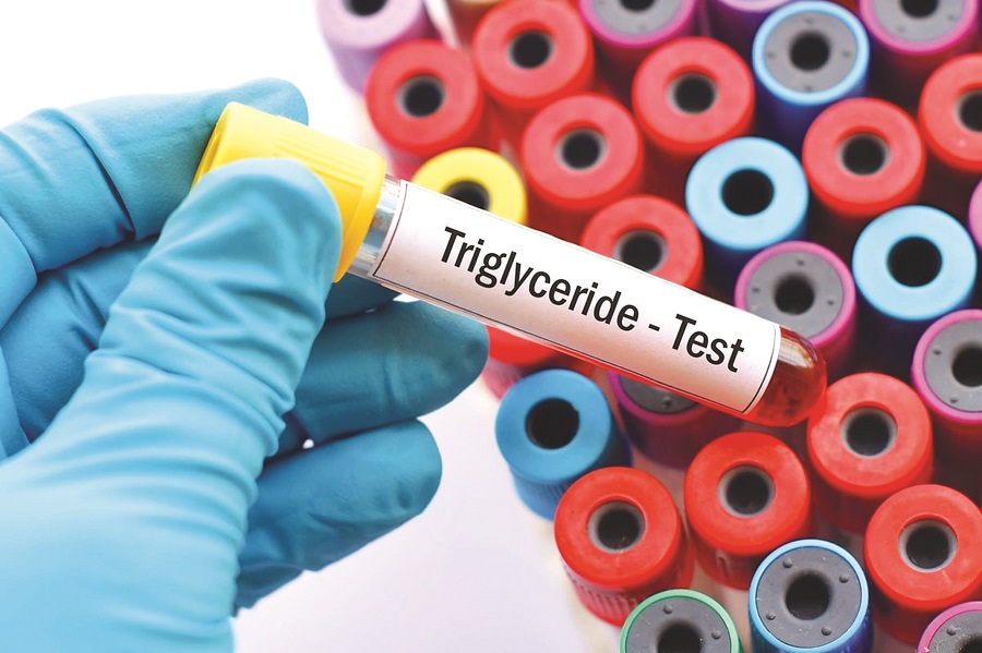 Dinh dưỡng cho bệnh nhân tăng Triglycerid máu - ảnh 1
