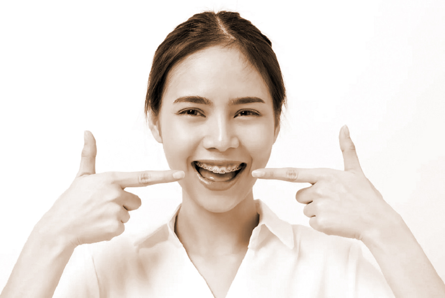 Niềng răng và lưu ý chăm sóc răng miệng - ảnh 1