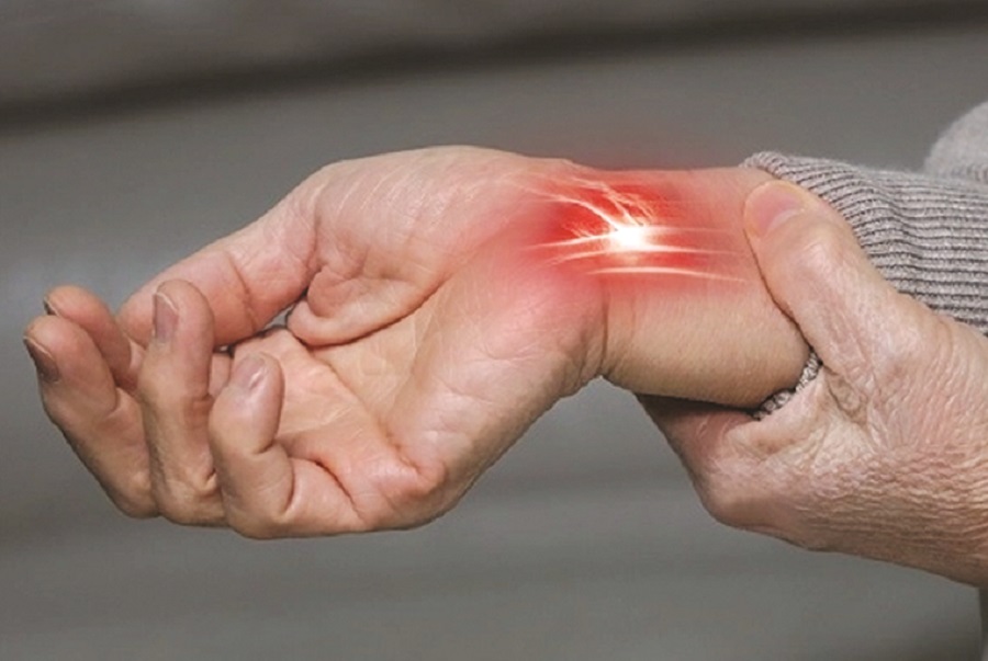 Hội chứng ống cổ tay - ảnh 1