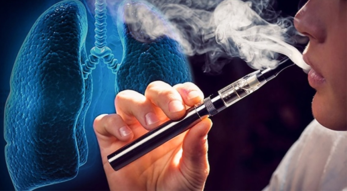 Thuế thuốc lá thấp: Rào cản với nỗ lực phòng, chống thuốc lá tại Việt Nam - ảnh 2