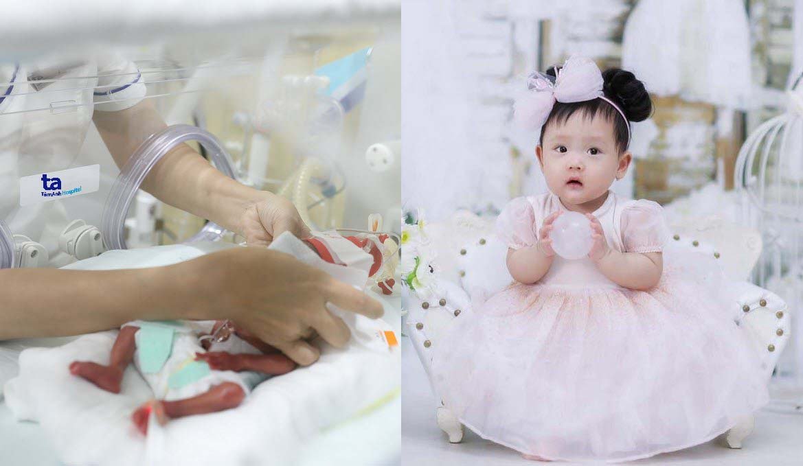 Phác đồ “giờ vàng’’ cứu sống hàng trăm trẻ sinh rất non - ảnh 2