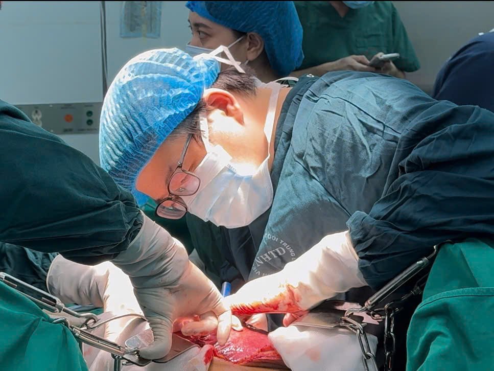 Cứu sống bệnh nhân ung thư gan muộn với khối u “khủng” 14cm - ảnh 2