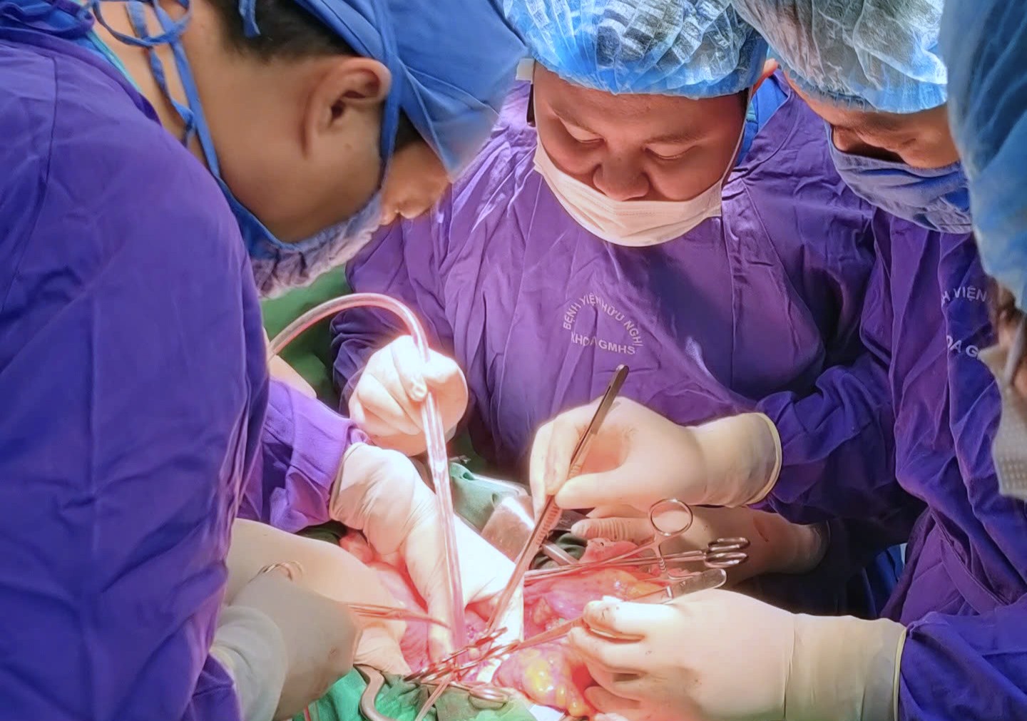 BV Hữu Nghị cứu sống người bệnh phình động mạch chủ và ung thư cùng lúc - ảnh 1