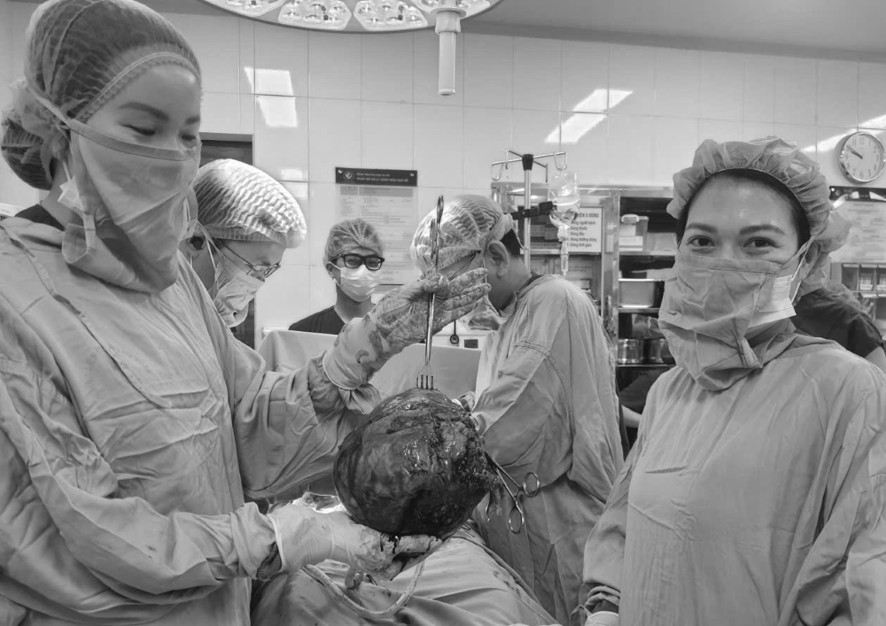 Bảo tồn tử cung thành công cho bệnh nhân có khối u xơ hơn 30cm - ảnh 1