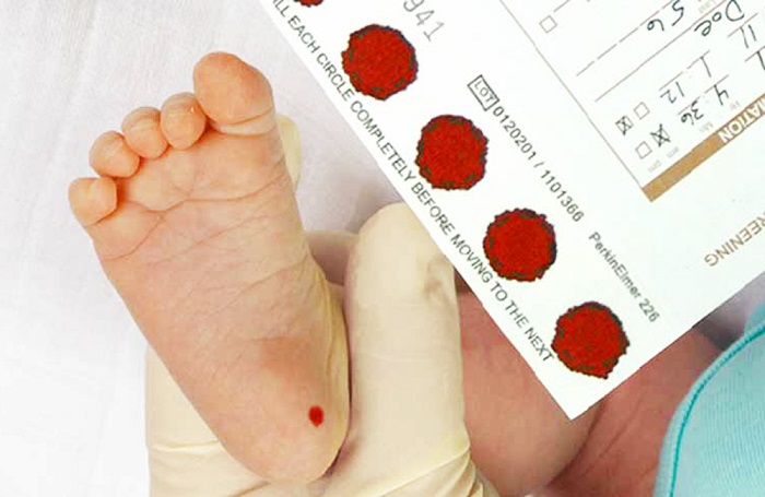Sàng lọc trước sinh, sơ sinh: Việc nhỏ, lợi ích lớn - ảnh 1