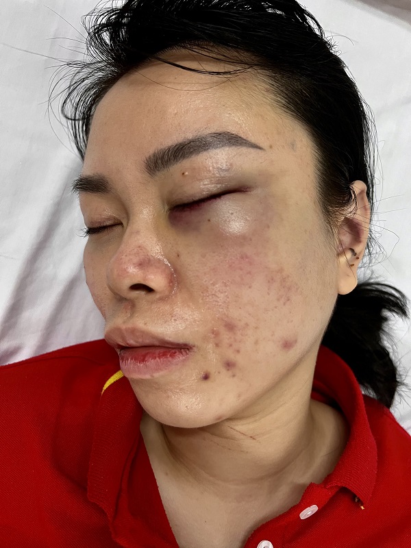 Sau ly hôn vẫn bị… chồng cũ bạo hành - ảnh 1