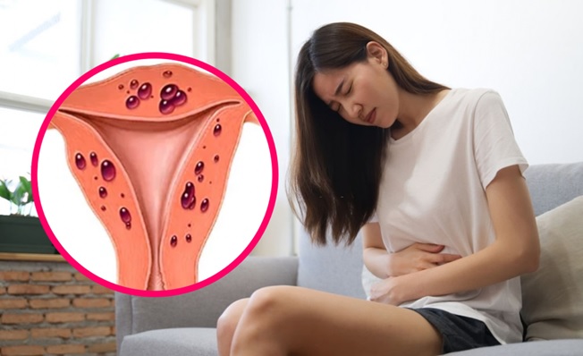 Điều trị nội khoa hay phẫu thuật? - ảnh 1