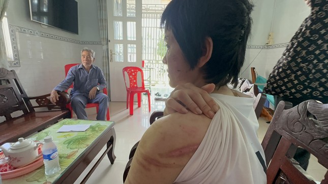 Liên tiếp xảy ra các vụ chồng bạo hành vợ nghiêm trọng - ảnh 1