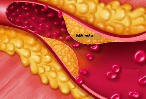 Làm thế nào để giảm mỡ máu? - ảnh 1