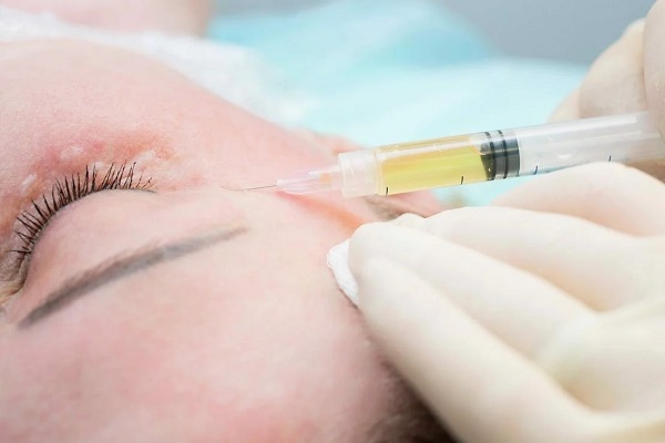 Rước họa vào thân vì “trẻ hóa” da cấp tốc - ảnh 1
