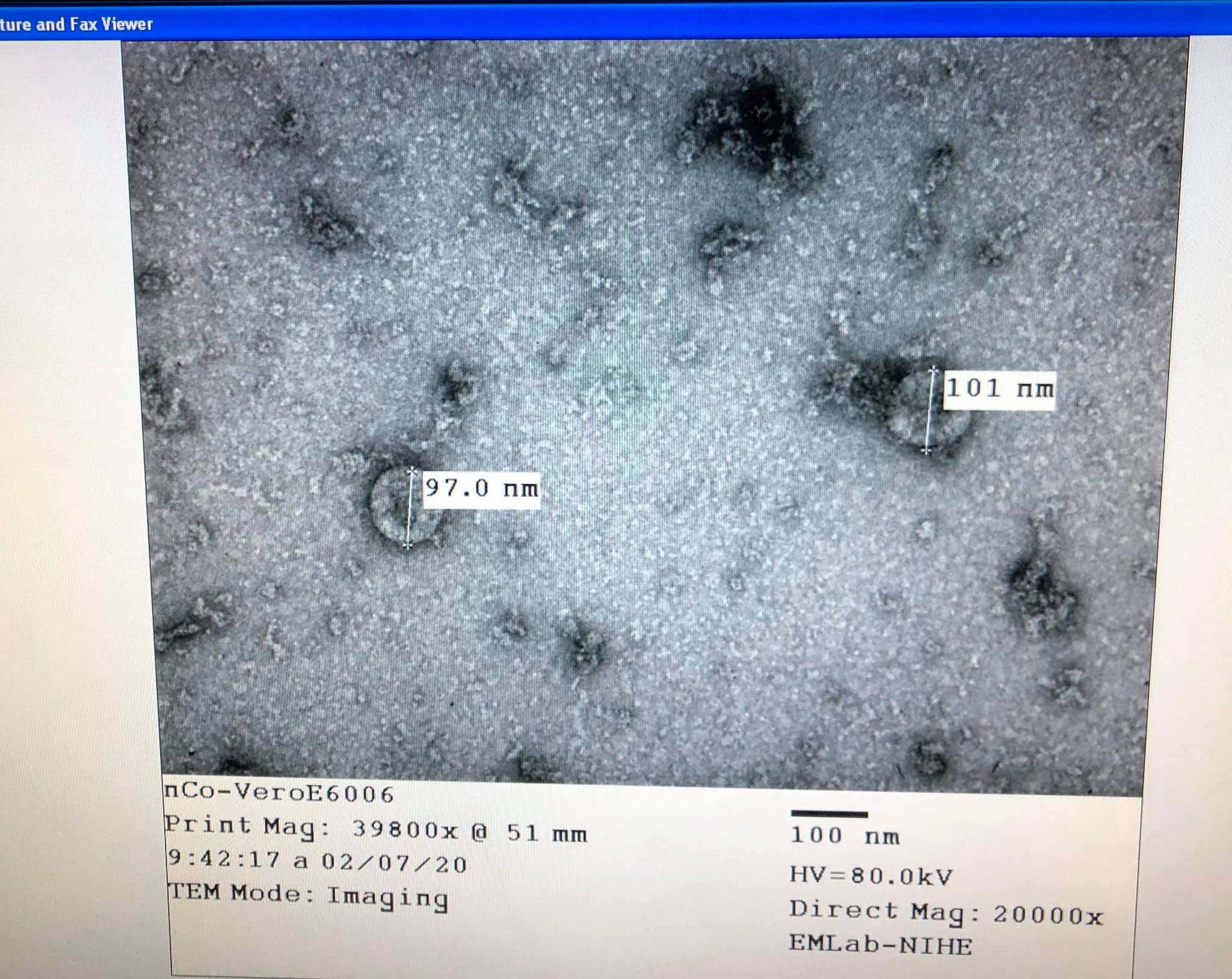 H&igrave;nh ảnh kết quả x&eacute;t nghiệm cho thấy Việt Nam nu&ocirc;i cấy l&agrave; ph&acirc;n ly th&agrave;nh c&ocirc;ng virus nCoV