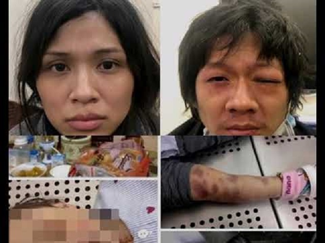 Cặp đôi cha dượng và mẹ đẻ thừa nhận việc đánh đập bé gái 3 tuổi dẫn đến tử vong.