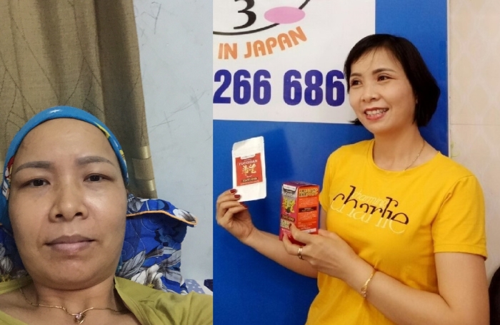 Chế độ dinh dưỡng khoa học, tập luyện thể dục và sử dụng thực phẩm chức năng chứa fucoidan... đã giúp chị Hiền tăng cường sức đề kháng, vượt qua quá trình hóa trị, xạ trị. Chế độ dinh dưỡng khoa học, tập luyện thể dục và sử dụng thực phẩm chức năng chứa fucoidan... đã giúp chị Hiền tăng cường sức đề kháng, vượt qua quá trình hóa trị, xạ trị.