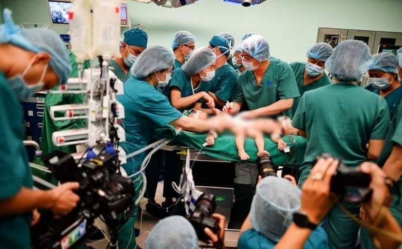 Các bác sĩ hoàn tất khâu chuẩn bị trước khi tiến hành tách đôi cặp song sinh dính liền vùng bụng.