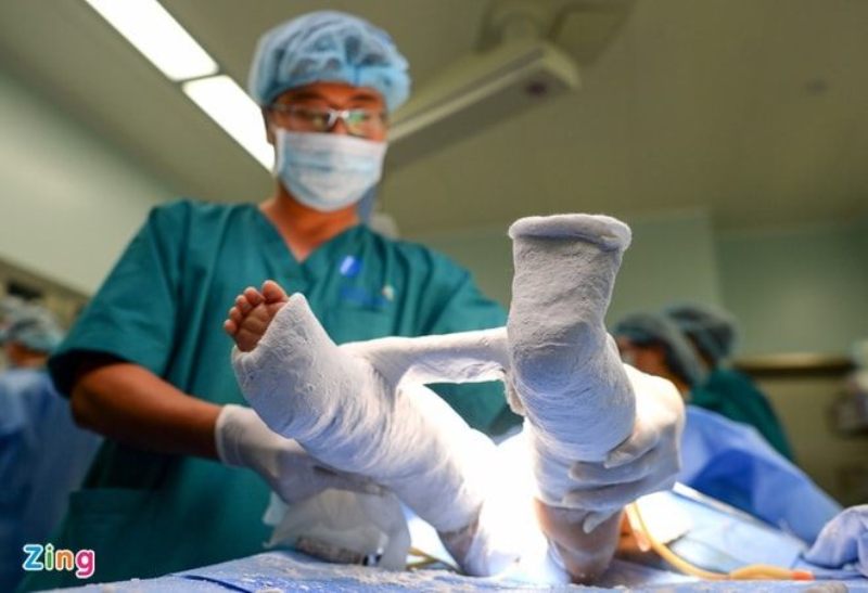 Các bác sĩ tiến hành phẫu thuật tạo hình cho từng bé sau ca đại phẫu tách rời cặp song sinh dính liền vùng bụng chậu. Các bác sĩ tiến hành phẫu thuật tạo hình cho từng bé sau ca đại phẫu tách rời cặp song sinh dính liền vùng bụng chậu.