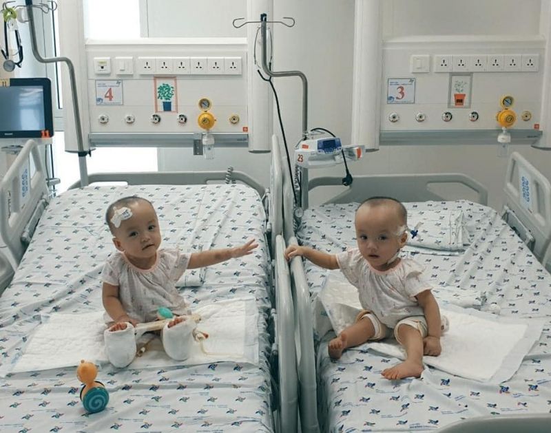 Kiểm soát nhiễm khuẩn của cặp song sinh dính liền đã được kiểm soát tốt. Kiểm soát nhiễm khuẩn của cặp song sinh dính liền đã được kiểm soát tốt.