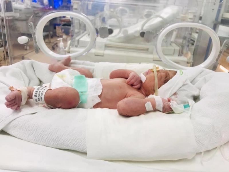 Dự kiến 1 tuần nữa, trẻ sẽ được xuất viện. Ảnh: VGP/Sim Nguyễn