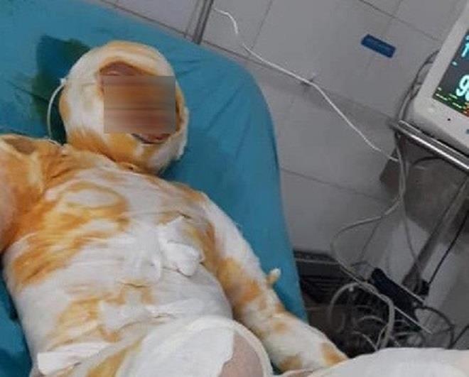 Nạn nh&acirc;n đang được điều trị tại bệnh viện