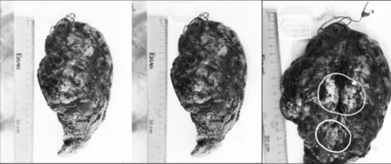 Hình ảnh đại thể mô bệnh phẩm phổi làm xét nghiệm giải phẫu bệnh Hình ảnh đại thể mô bệnh phẩm phổi làm xét nghiệm giải phẫu bệnh