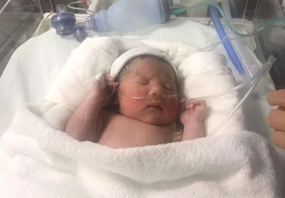 Em bé bé sinh ra nặng 3.100g,