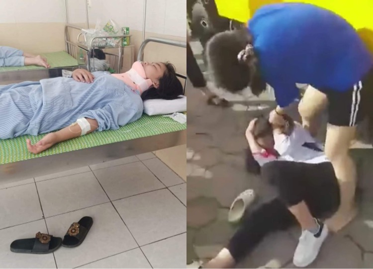 Nữ sinh H bị đánh phải nhập viện