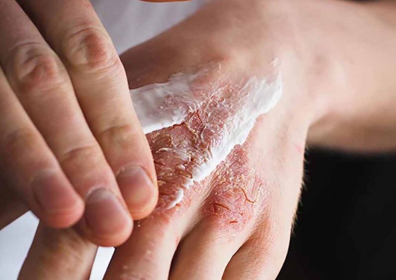 Ảnh minh họa. Nguồn: Int