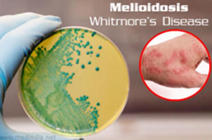 Ảnh minh họa. Nguồn: Internet.