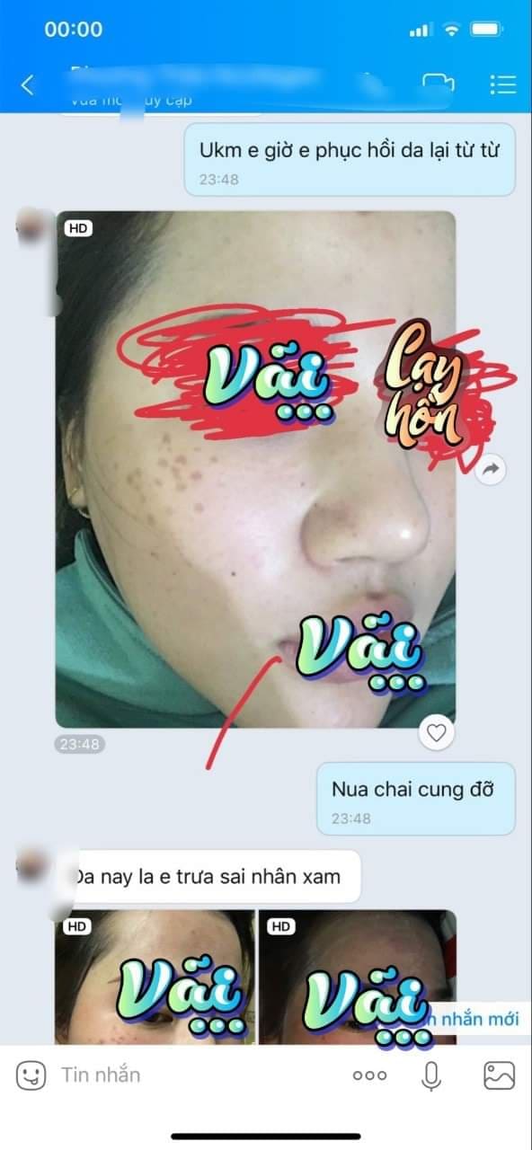 Người ti&ecirc;u d&ugrave;ng đ&agrave;nh ngậm ng&ugrave;i