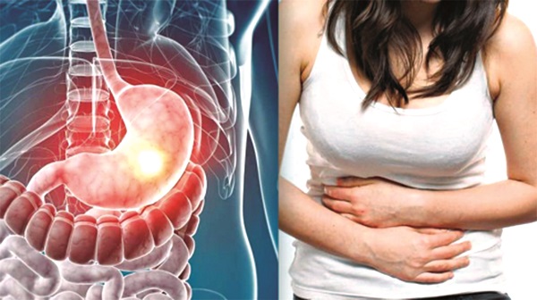 Nhiễm vi khuẩn HP có cần quá lo lắng? - ảnh 1