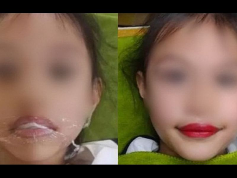 Hình ảnh bé gái 5 tuổi xăm môi dược chia sẻ trên mạng xã hội khiến dư luận xôn xao. Nguồn: Int