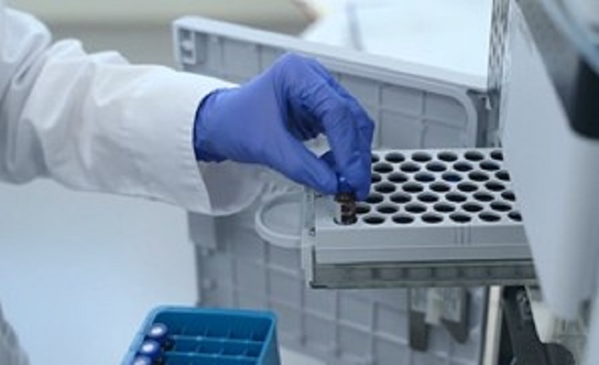 Công nghệ phát hiện virus SARS-CoV-2 trong 5 phút - ảnh 1