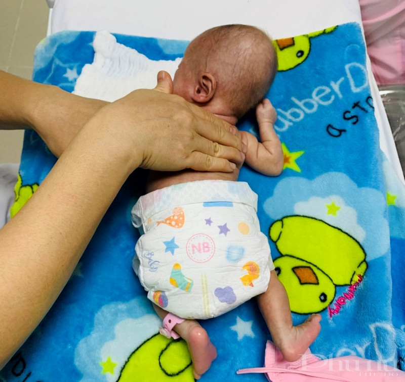 Bác sĩ bệnh viện Phụ sản Trung ương thực hiện massage cho bé T.A Bác sĩ bệnh viện Phụ sản Trung ương thực hiện massage cho bé T.A