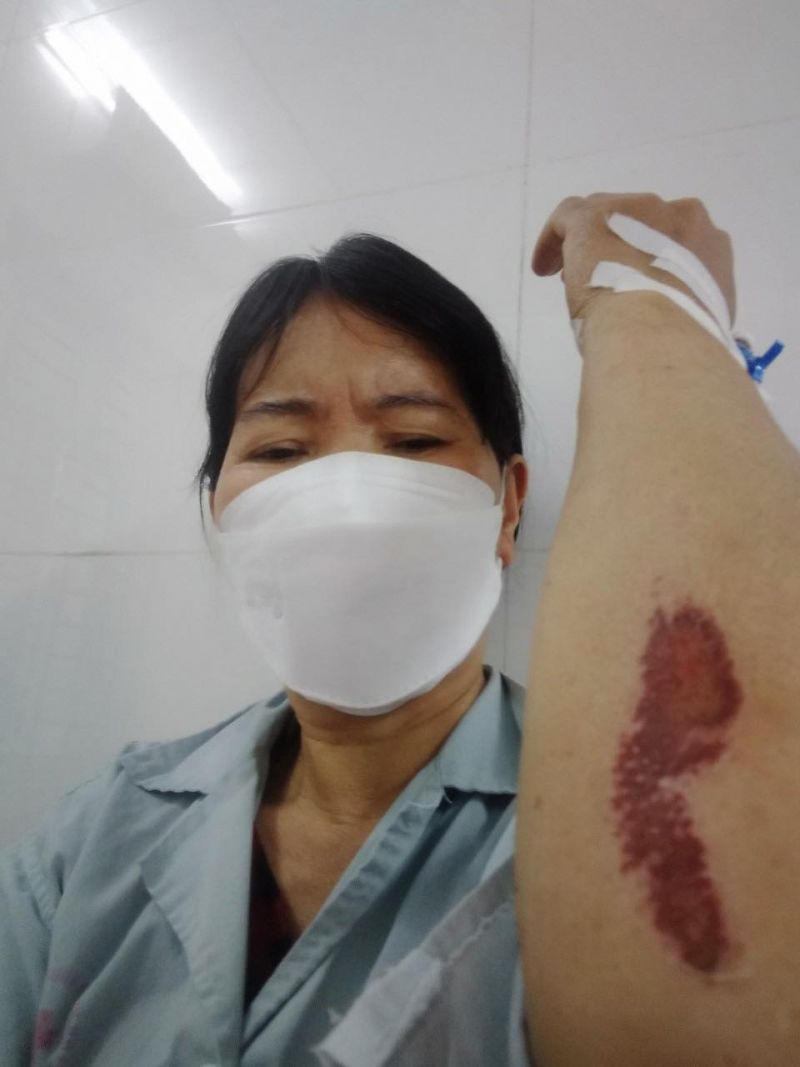 Bà L bị nhóm côn đồ tấn công phải nhập viện