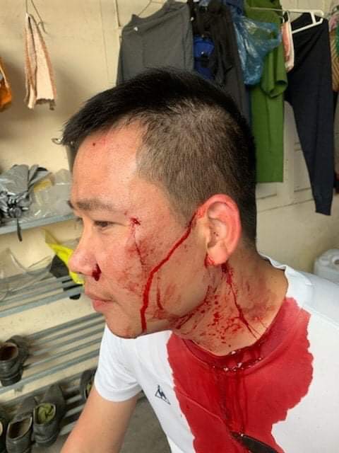 Tài xế xe khách bị “cò mồi” đánh trọng thương trong Bến xe Mỹ Đình