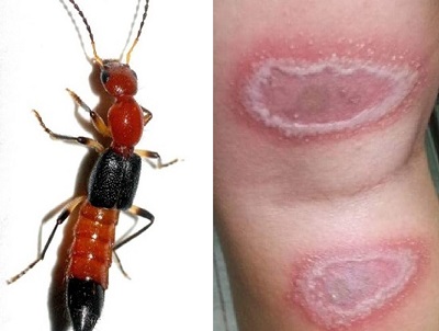Kiến ba khoang tái xuất “tấn công” người - ảnh 1