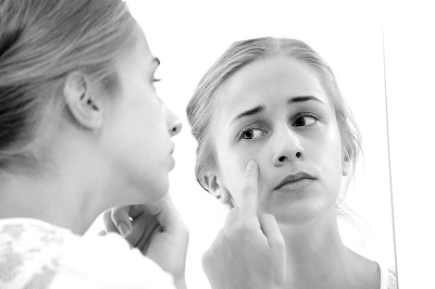 Điều trị “mụn” ở người trưởng thành - ảnh 1