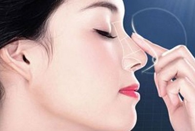 Nâng mũi, coi chừng biến chứng! - ảnh 1