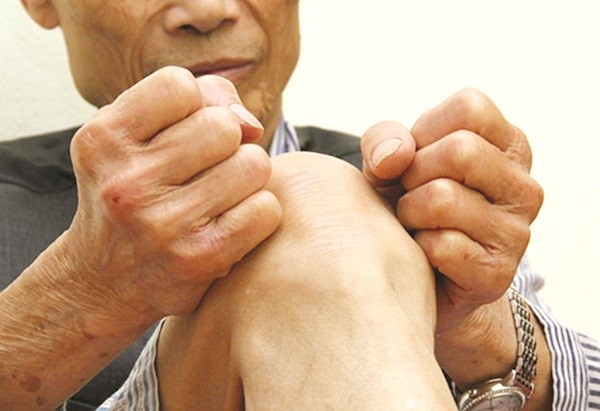 Thoái hóa khớp gối ở người trung niên và cao tuổi - ảnh 1