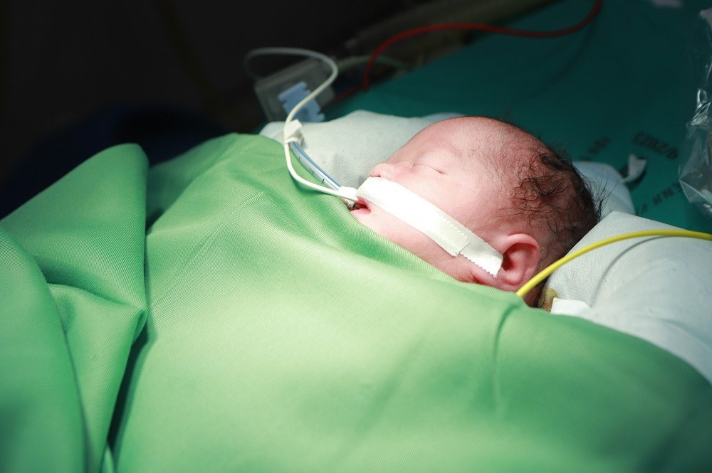 Kịp thời phẫu thuật, đặt máy tạo nhịp tim ngay tại phòng sinh cho em bé bị tim bẩm sinh - ảnh 3