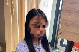 Hà Nội: Công an đang giám định thương tích một nữ sinh lớp 8 bị đánh hội đồng - ảnh 1