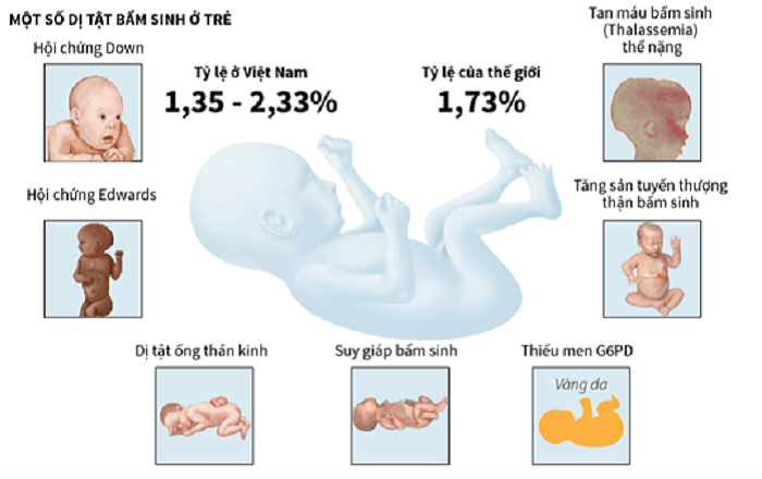 Tầm soát trước và sơ sinh: Giải pháp nâng cao chất lượng dân số - ảnh 2