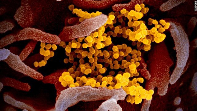 Hình ảnh chủng mới virus corona gây dịch COVID-19 (màu cam) dưới kính hiển vi.