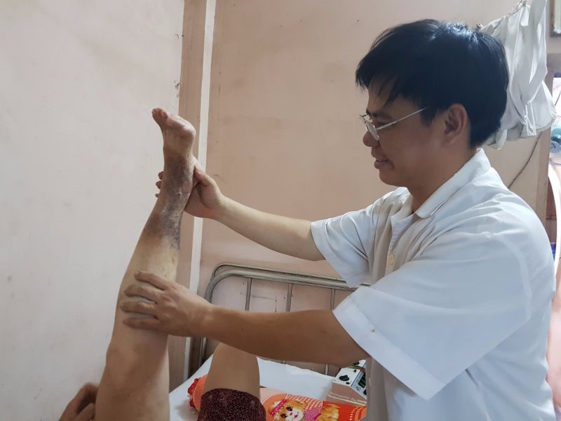 Nhiều bệnh nhân chân tím đen vì suy giãn tĩnh mạch được lương y chữa khỏi.
