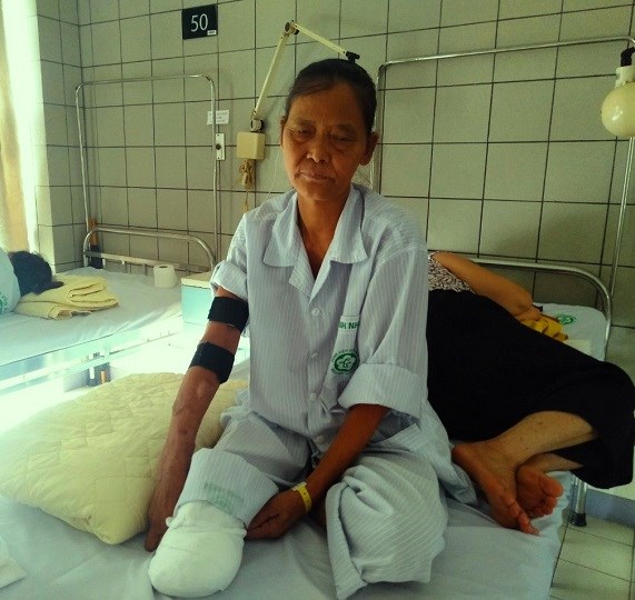 bà Ngô Thị Bích đang điều trị tạibệnh viện