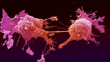 Phát hiện trường hợp tế bào ung thư truyền từ mẹ sang con - ảnh 1