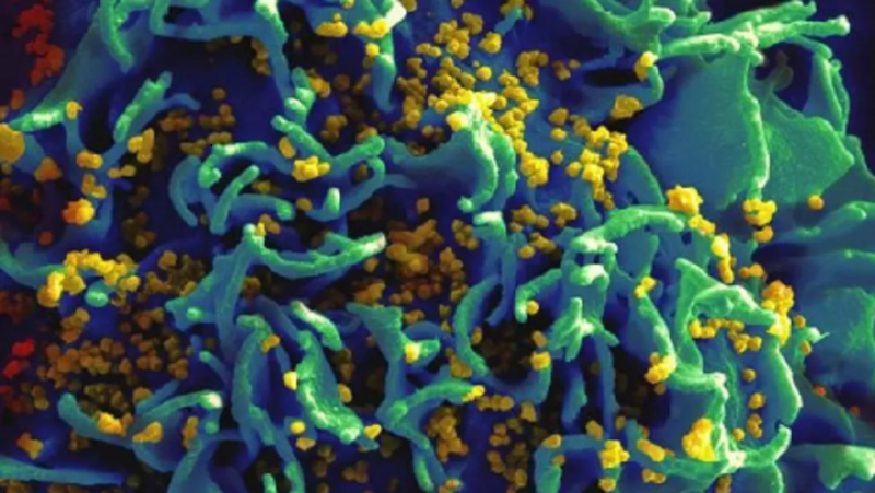 Sắp thử nghiệm lâm sàng vaccine ngừa HIV - ảnh 1