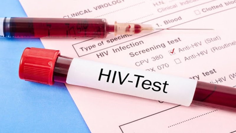 Xét nghiệm HIV sau 2-3 tháng phơi nhiễm khá chính xác, chính xác nhất là sau 4 tháng